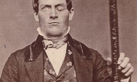 Phineas Gage and the effect on